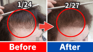 骨格矯正/育毛発毛ヘッドスパ