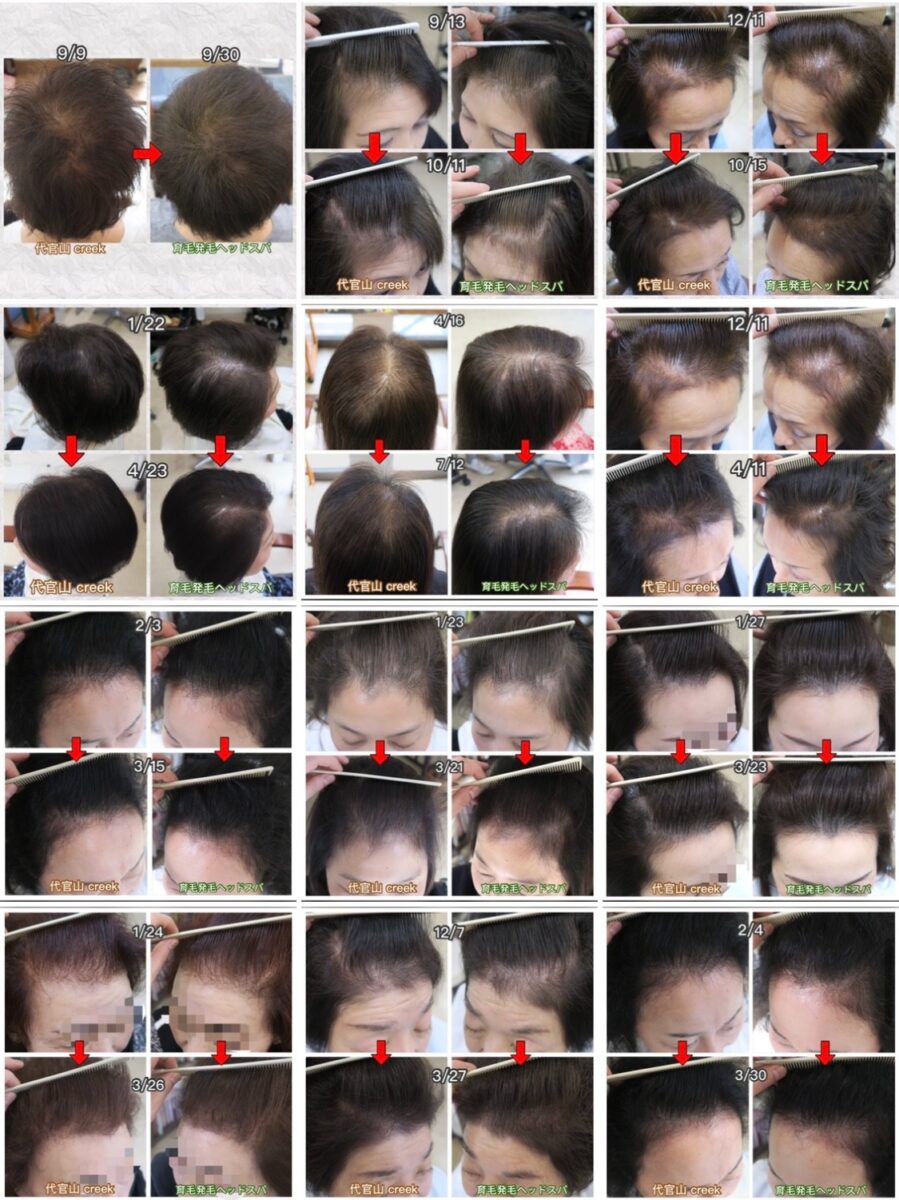 薄毛改善の技術でお客様に喜ばれながら、月に15日休業できるサロンを増やしたい！