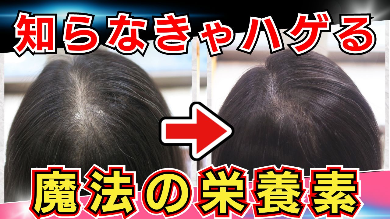【女性の薄毛】魔法の栄養素で改善する方法を徹底解説