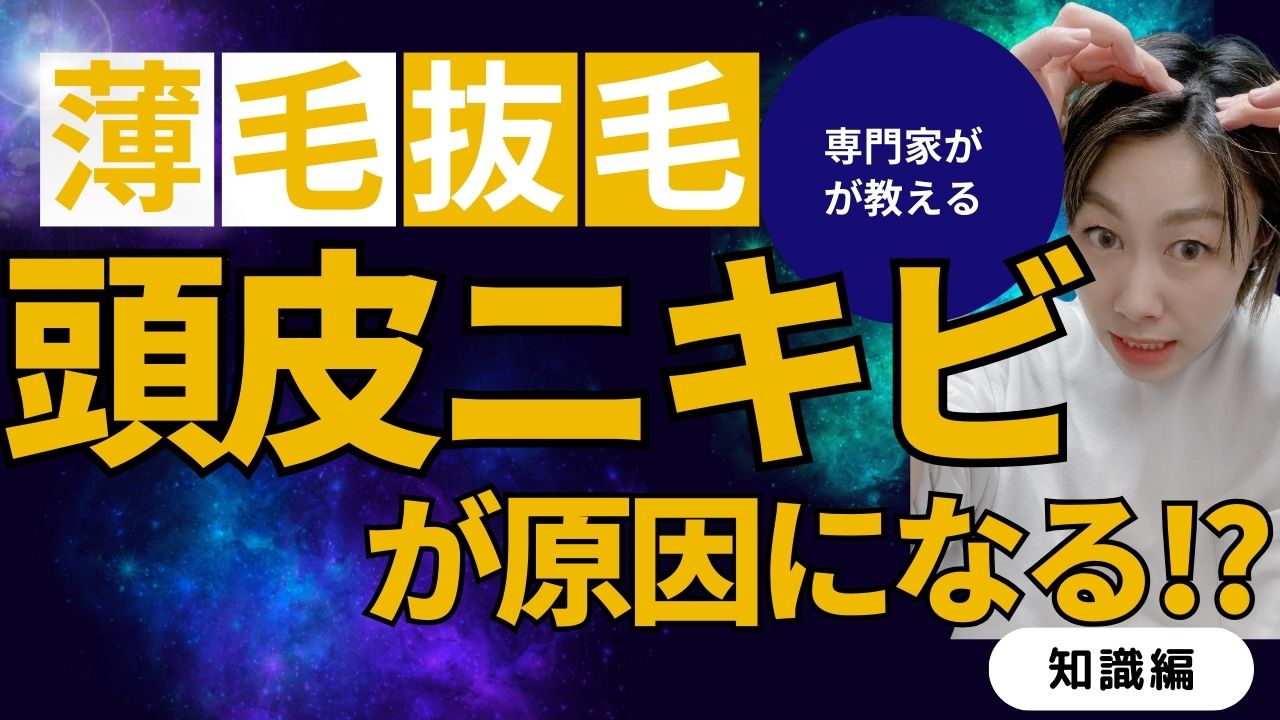頭皮ニキビが薄毛を呼ぶ？専門家直伝のケア方法でリスク回避！