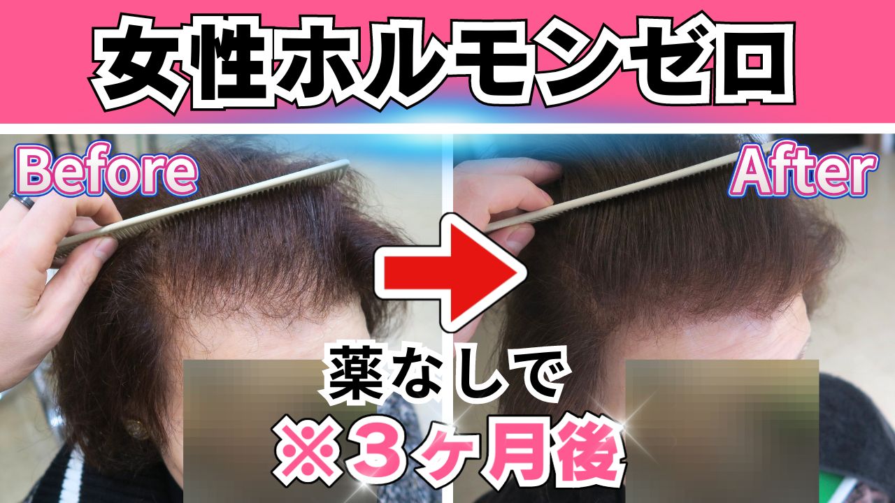 73歳でも！女性ホルモンゼロから薄毛を改善できるは本当？