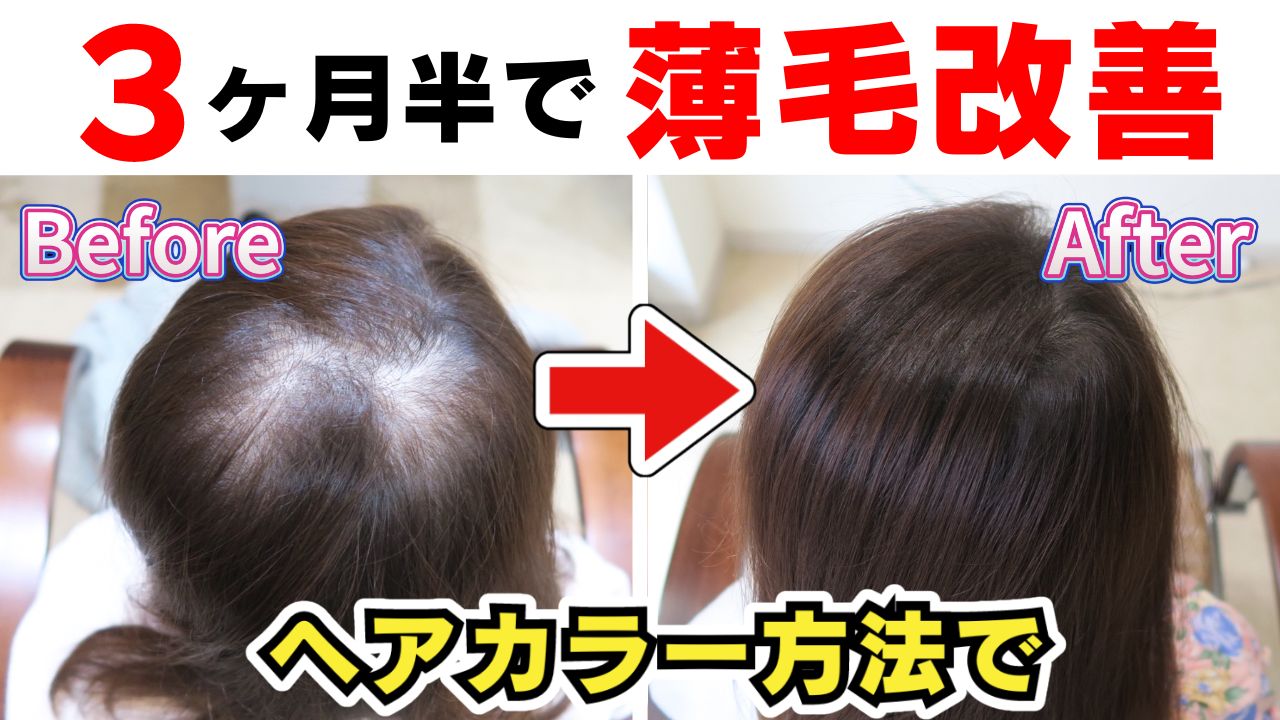 薄毛が目立たない髪色!3ヶ月半で薄毛改善したヘアカラー方法