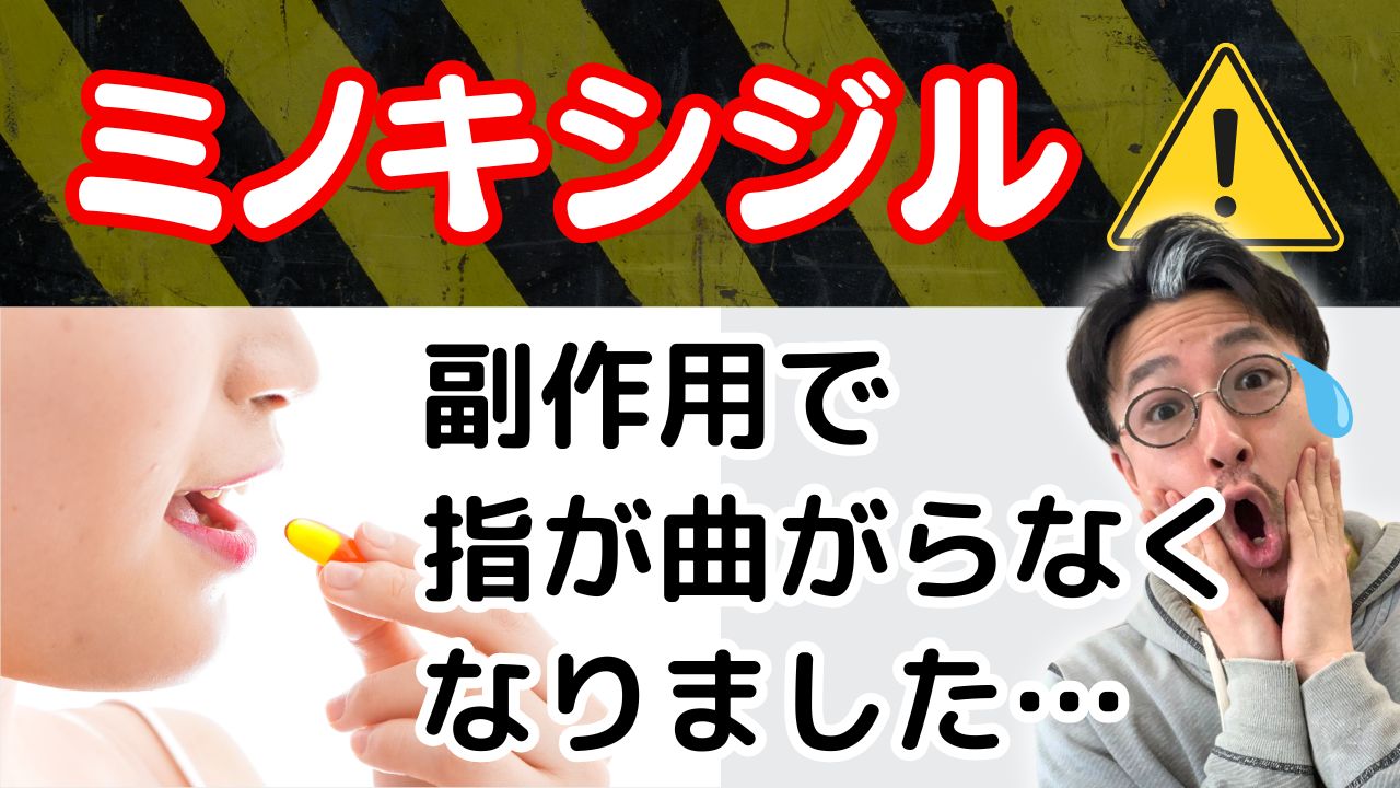 【医師の証言!】AGA•ミノキシジル薄毛治療の副作用を解説