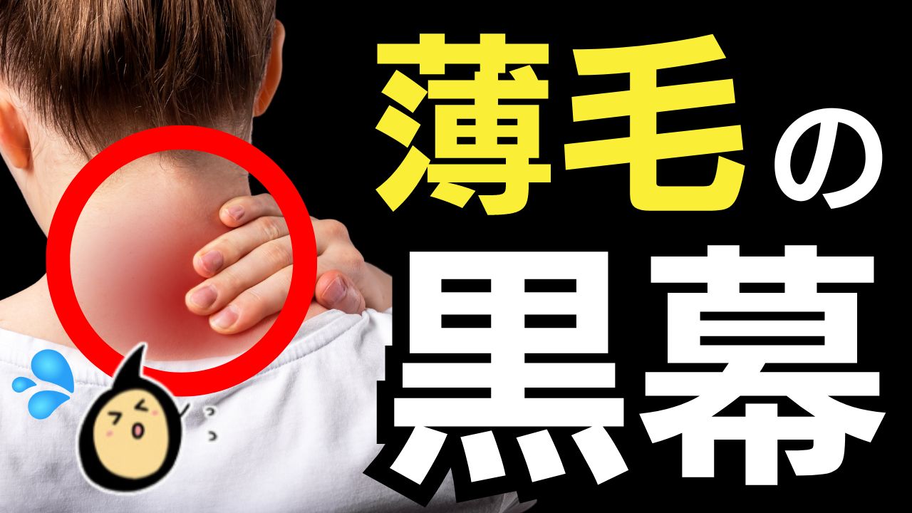 抜け毛がひどい30代女性！薬なしで17日間で薄毛改善できた方法