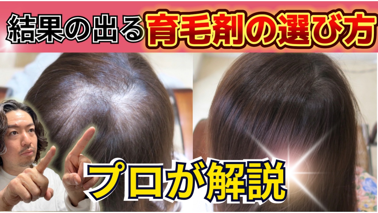 プロが解説!効果のある育毛剤の選び方