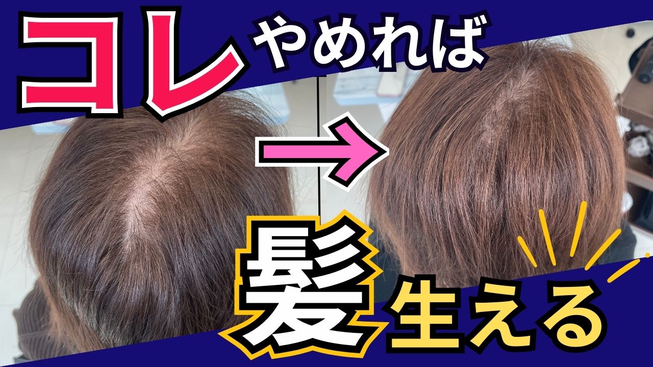 【頭皮ケア完全ガイド】女性の薄毛対策、知らなきゃ損する重要ポイント！