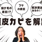 <span class="title">プロが教える！頭皮カビを見逃すと薄毛に直結する残念な理由と解決策</span>