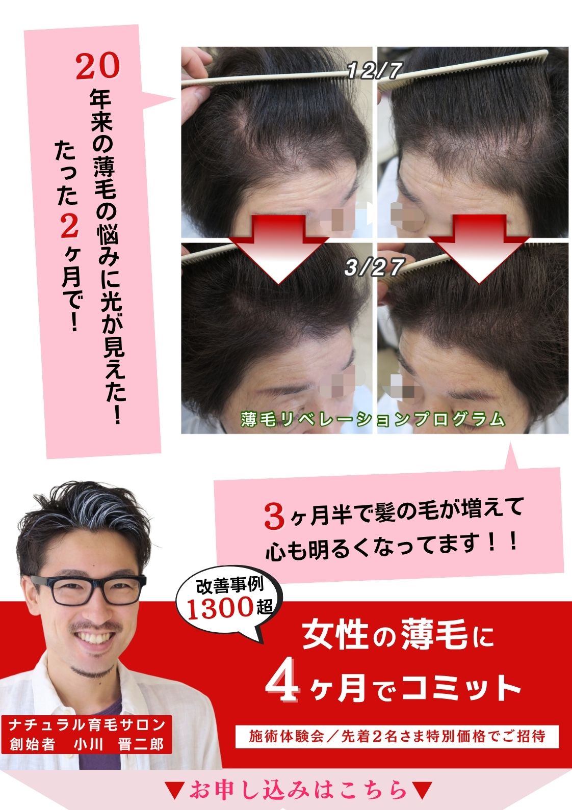 施術体験会ファーストビュー(スマホ).jpg