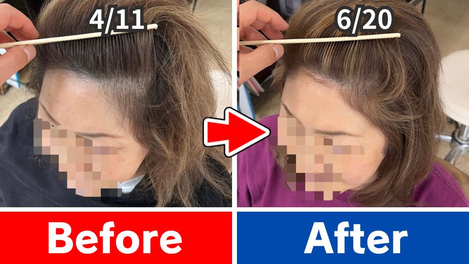 60代女性 Before After