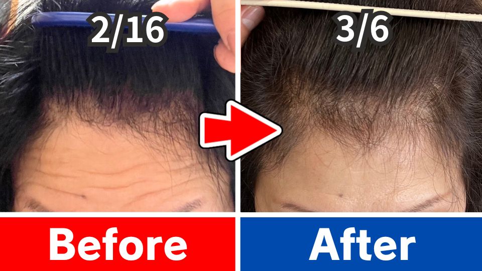 50代女性 Before After